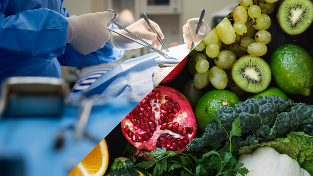 Endometriosis Surgery and Nutrition