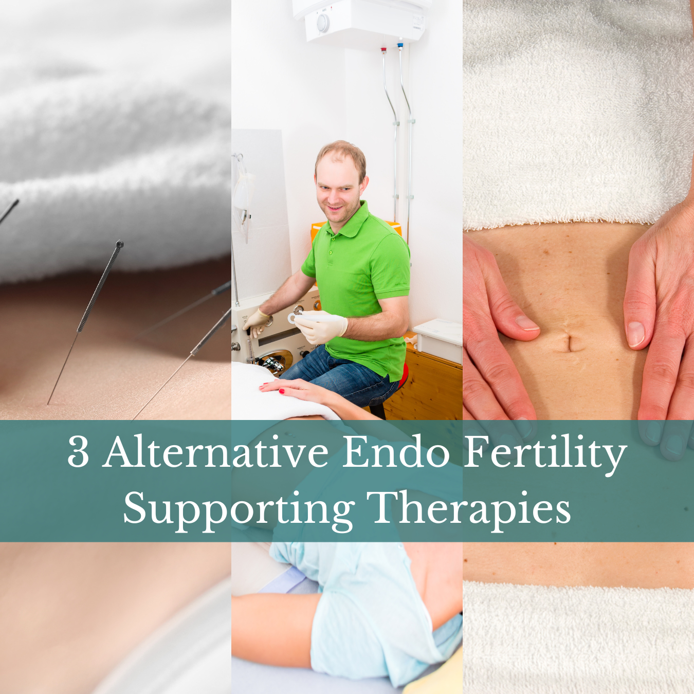 Acupuncture, Colonics, and More: Alternative Therapies for Endometriosis and Fertility